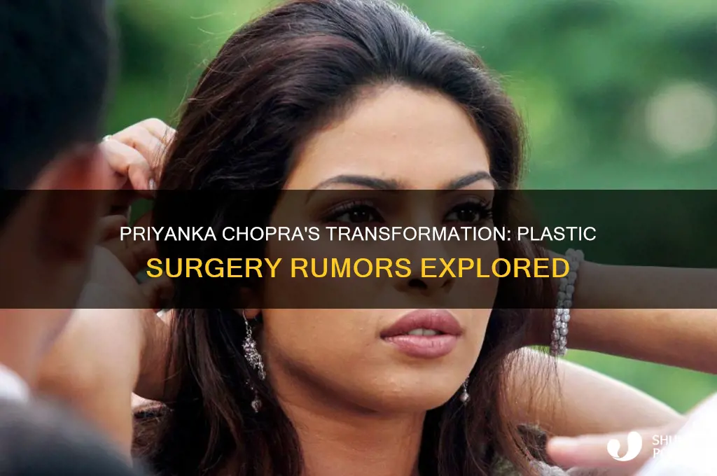 has priyanka chopara had plastic surgery
