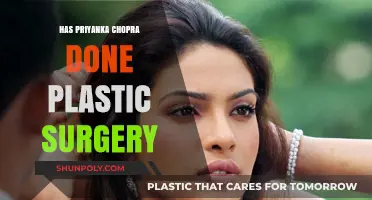 Priyanka Chopra's Transformation: Plastic Surgery Rumors Explored and Debunked