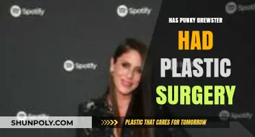 Has Punky Brewster Had Plastic Surgery? Unveiling the Truth