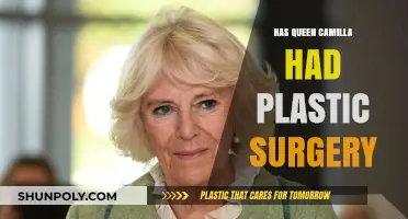 Queen Camilla's Transformation: Plastic Surgery Speculations and Royal Beauty