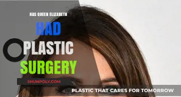 Queen Elizabeth's Youthful Appearance: Plastic Surgery Speculations Explored