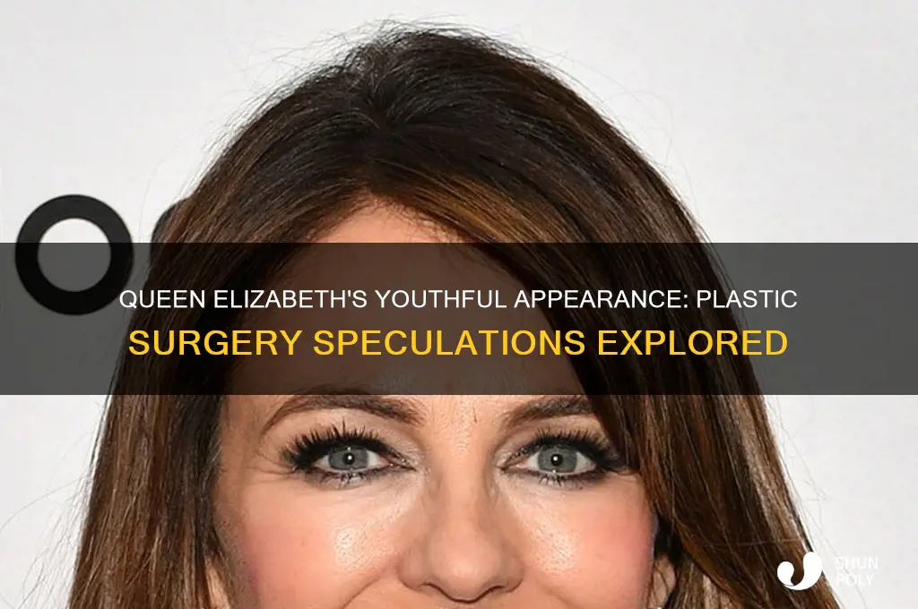 has queen elizabeth had plastic surgery