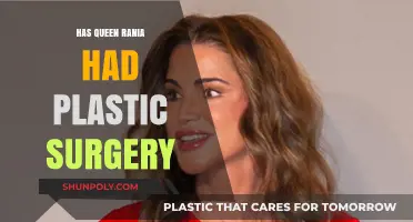 Queen Rania's Beauty Secrets: Plastic Surgery Speculations Explored