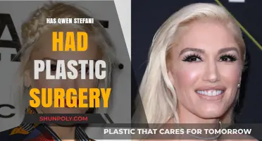 Has Gwen Stefani Undergone Plastic Surgery? Exploring the Rumors