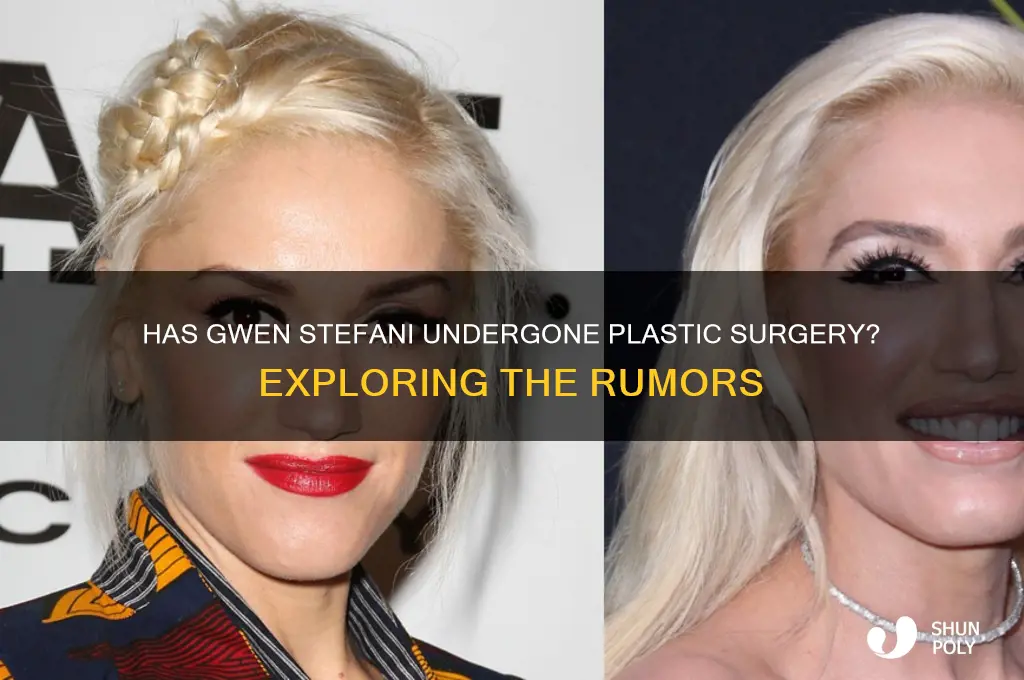 has qwen stefani had plastic surgery