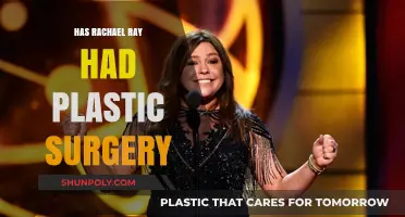 Rachael Ray's Transformation: Plastic Surgery Rumors Explored and Debunked