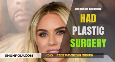 Rachel Bradshaw's Transformation: Plastic Surgery Speculations and Truths Revealed