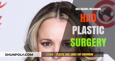 Rachel McAdams Plastic Surgery: Fact-Checking the Rumors and Speculations