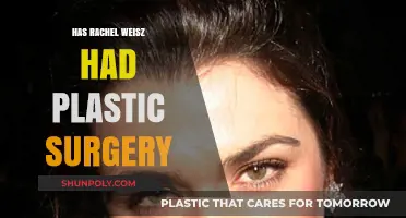 Rachel Weisz's Ageless Beauty: Plastic Surgery Speculations Explored