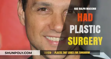 Ralph Macchio Plastic Surgery: Fact or Fiction? Unveiling the Truth