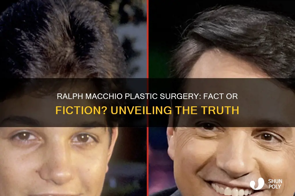 has ralph macchio had plastic surgery