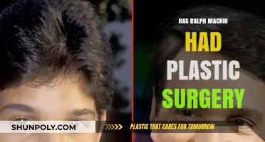 Ralph Macchio's Youthful Look: Plastic Surgery or Natural Aging?