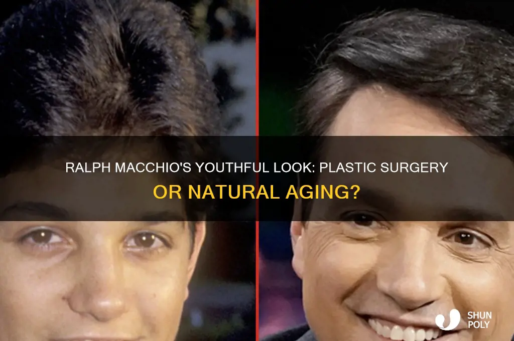 has ralph machio had plastic surgery