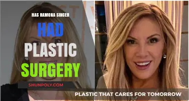 Ramona Singer's Transformation: Plastic Surgery Rumors and Reality Revealed