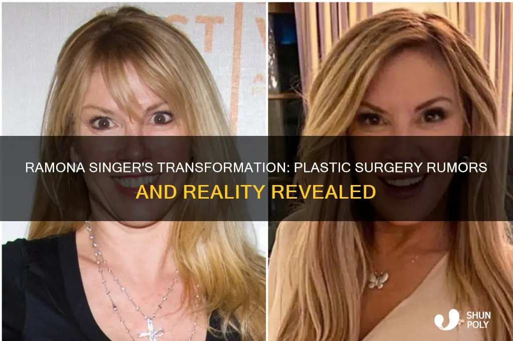 has ramona singer had plastic surgery