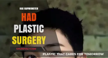 Rap Monster's Transformation: Plastic Surgery Rumors and Reality