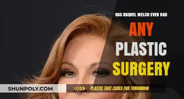 Raquel Welch's Beauty Secrets: Plastic Surgery Rumors Explored