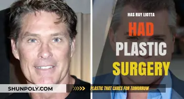Ray Liotta's Appearance: Plastic Surgery Rumors Explored and Analyzed