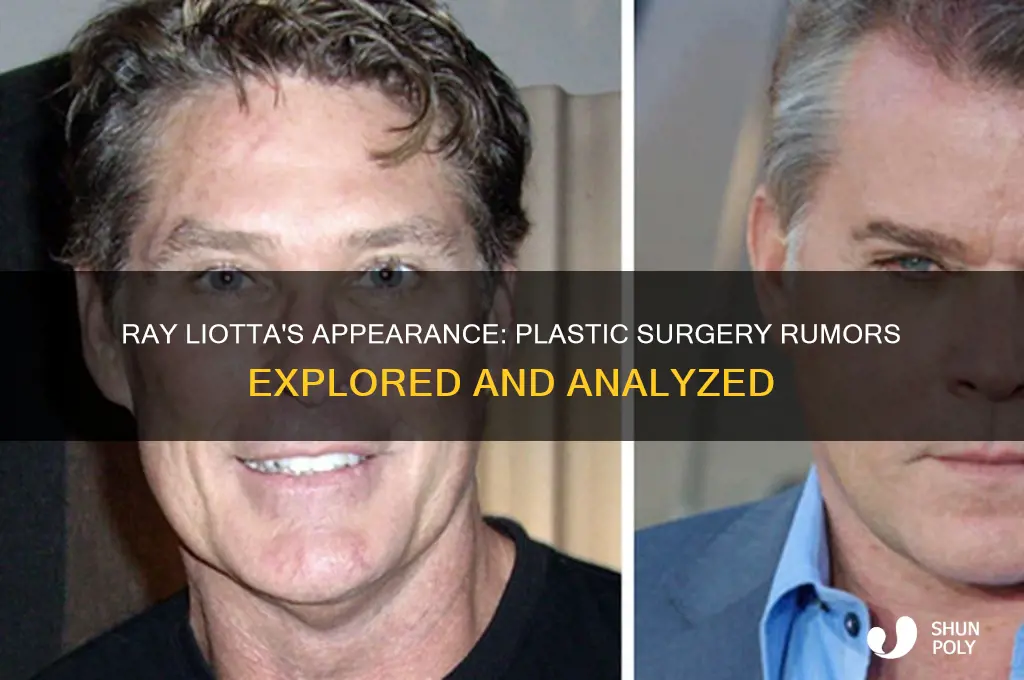 has ray liotta had plastic surgery