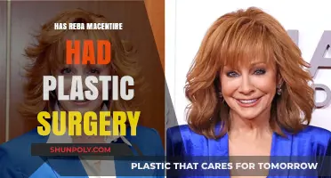 Reba McEntire's Transformation: Plastic Surgery Rumors Explored