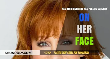 Reba McEntire's Face: Natural Beauty or Plastic Surgery Transformation?