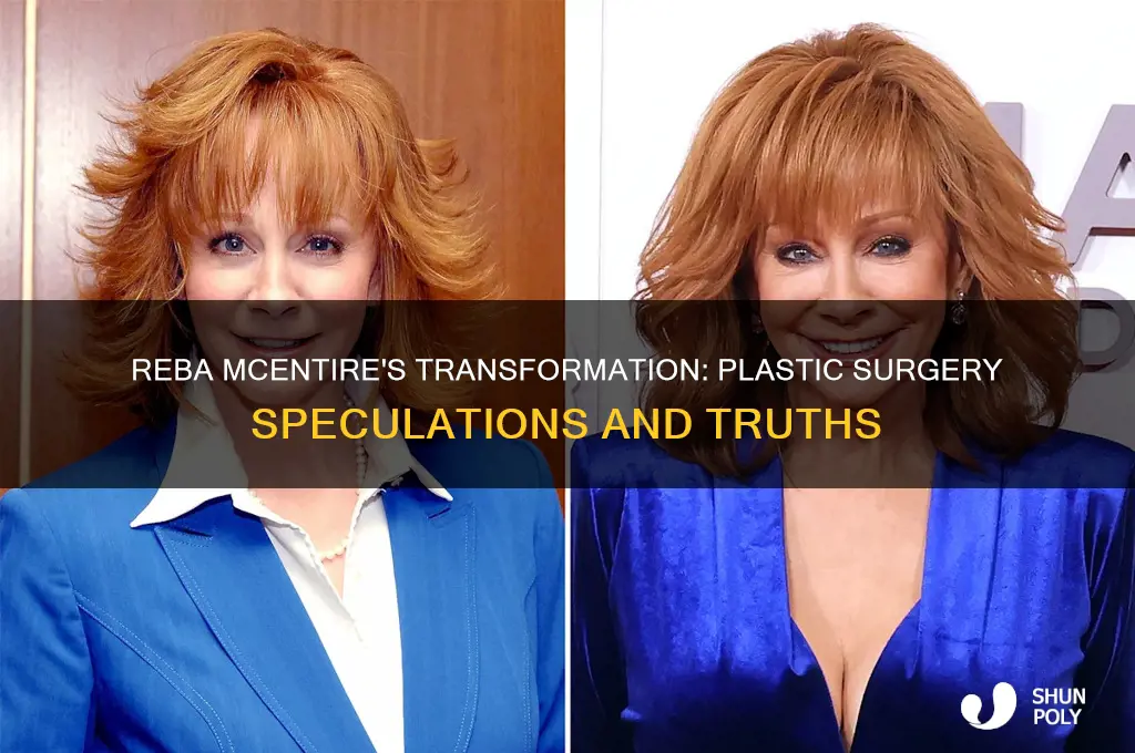 has reba mcintyre had plastic surgery