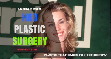 Rebecca Romijn's Transformation: Plastic Surgery Speculations and Truths