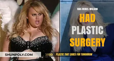 Rebel Wilson's Transformation: Plastic Surgery Rumors Explored and Debunked