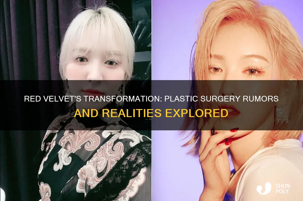 has red velvet gotten plastic surgery