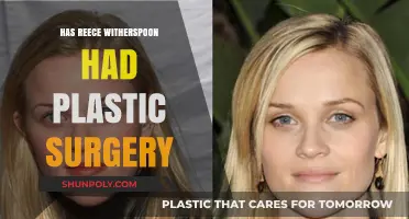 Reese Witherspoon's Transformation: Plastic Surgery Rumors Explored