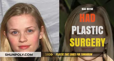 Reese Witherspoon's Transformation: Plastic Surgery Rumors Explored