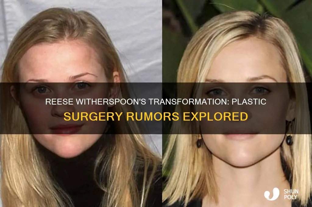 has reese had plastic surgery