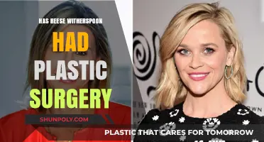 Reese Witherspoon's Transformation: Plastic Surgery Rumors Explored