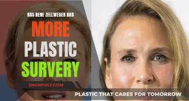 Rene Zellweger's Transformation: Plastic Surgery or Natural Evolution?