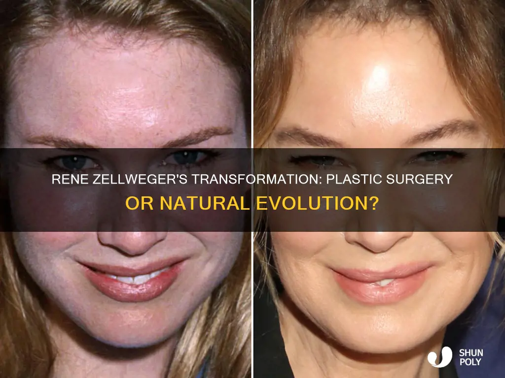 has rene zellweger had more plastic survery