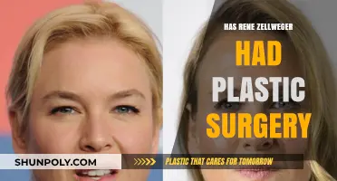 Rene Zellweger's Transformation: Plastic Surgery Speculations and Truths