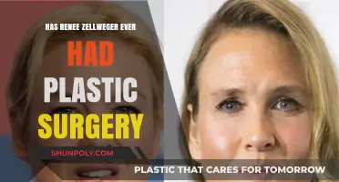 Renee Zellweger Plastic Surgery: Fact or Fiction? Unveiling the Truth