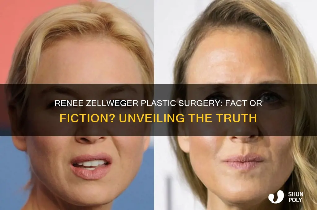 has renee zellweger ever had plastic surgery