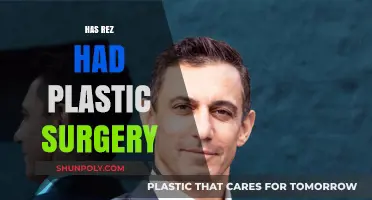 Has Rez Had Plastic Surgery? Uncovering the Truth Behind the Rumors