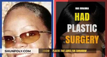 Rihanna's Transformation: Plastic Surgery Rumors and the Truth Behind Them