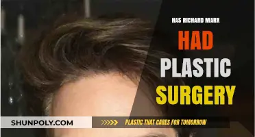 Richard Marx Plastic Surgery: Fact-Checking the Rumors and Speculations