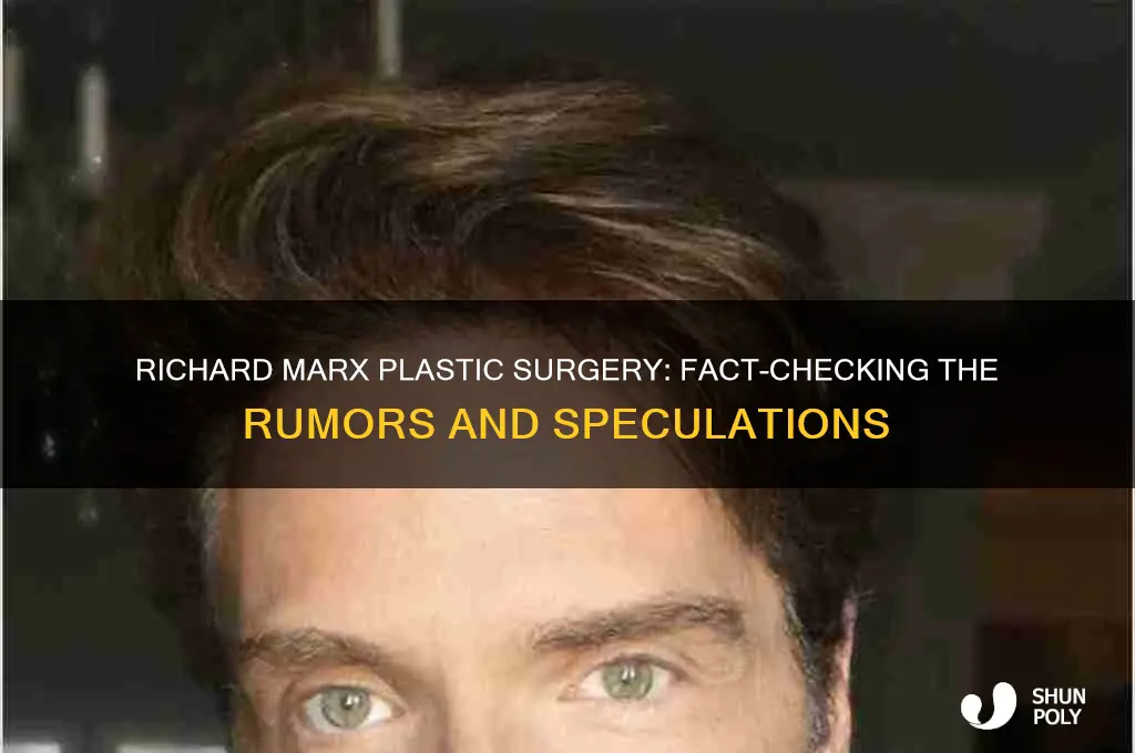 has richard marx had plastic surgery
