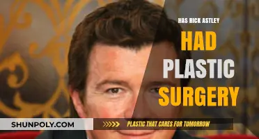 Has Rick Astley Had Plastic Surgery? Unveiling the Truth