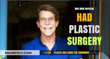 Rick Bayless Plastic Surgery: Fact-Checking the Chef's Transformation Rumors