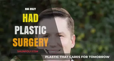 Riley's Transformation: Plastic Surgery Speculations and the Truth Revealed