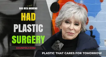 Rita Moreno's Ageless Beauty: Plastic Surgery Speculations Explored