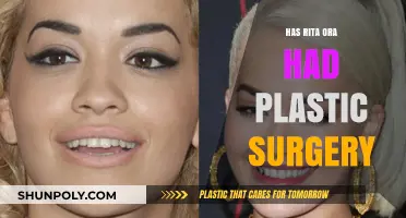 Rita Ora's Transformation: Plastic Surgery Rumors and Reality Revealed