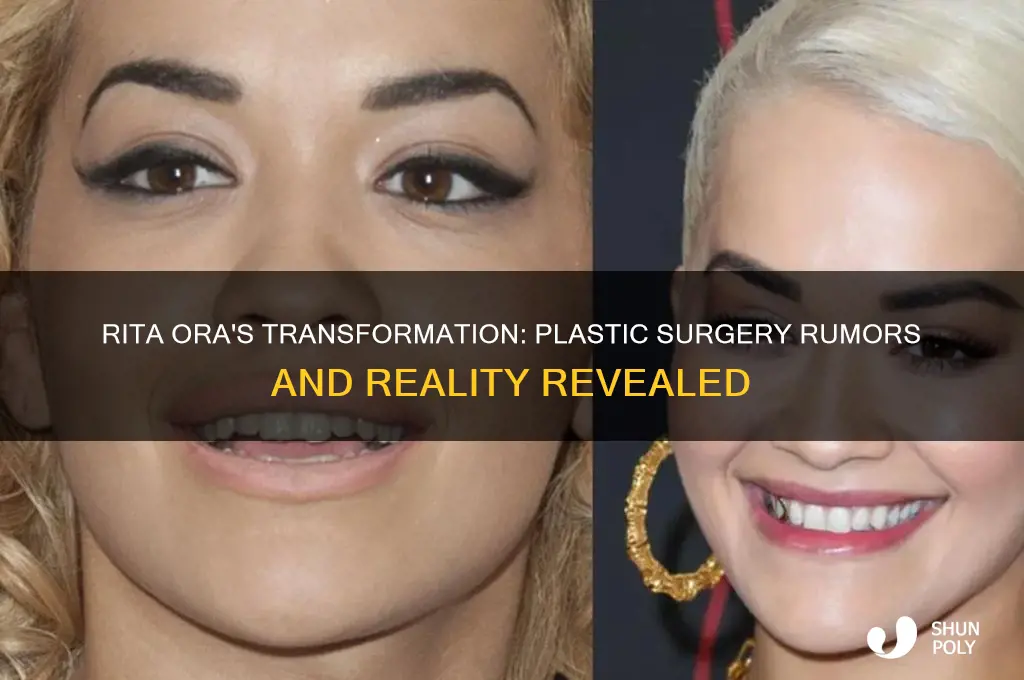 has rita ora had plastic surgery