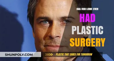 Rob Lowe's Ageless Look: Plastic Surgery Rumors Explored