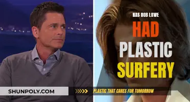 Rob Lowe's Plastic Surgery: Fact or Fiction?